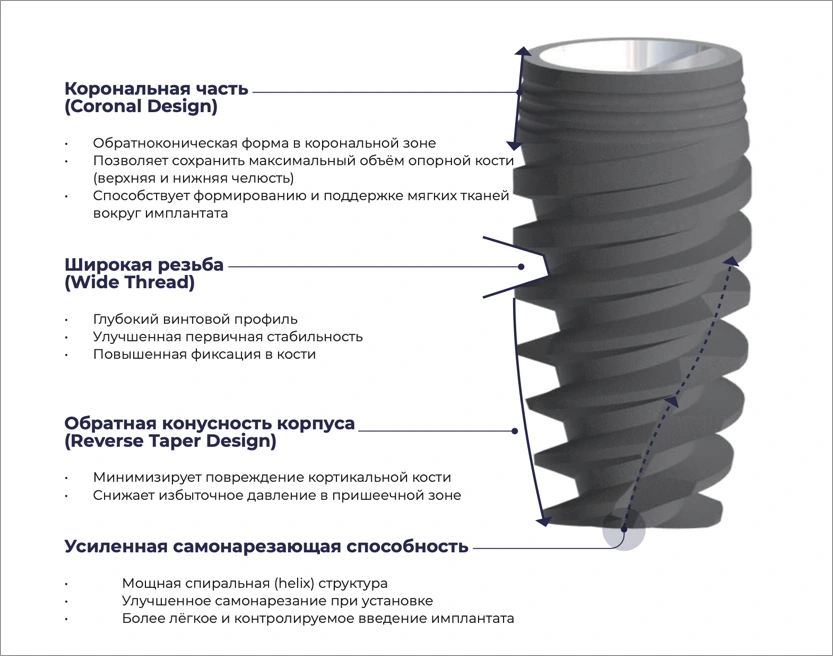 Имплант серии Nx